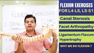 Flexion Exercises For Lumbar Canal Stenosis Facet Joint Arthropathy Ligamentum Flavum Hypertrophy [upl. by Eitsyrc830]