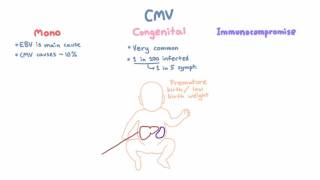 CMV Clinical Syndromes  Mono Congenital Infection Immunocompromised Hosts [upl. by Ivzt777]