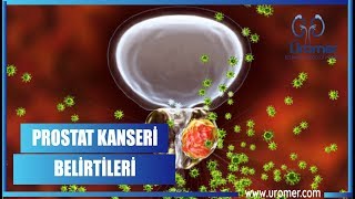 PROSTAT KANSERİ BELİRTİLERİ [upl. by Nnaacissej]