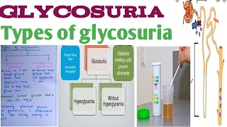 GlycosuriaEasy exam notes in hindi [upl. by Merl]