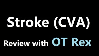 OT Rex  Stroke CVA Review  Cause Signs Symptoms Treatment [upl. by Vern226]