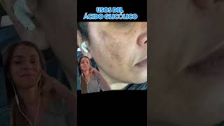 Para qué sirve el ácido glicólico skincare drapascali acidoglicolico [upl. by Dleifrag]