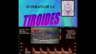 ECOGRAFIA DOPPLER DE TIROIDES [upl. by Fenn]