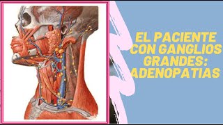 EL PACIENTE CON GANGLIO GRANDES ADENOPATIAS [upl. by Prescott]