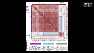 Trends in Neuroimaging Analysis Virtual Talk at the University of Connecticut [upl. by Sonitnatsnok]