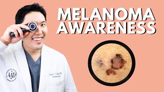 Melanoma Awareness Info from a Board Certified Dermatologist [upl. by Jp714]