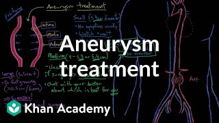 Aneurysm treatment  Circulatory System and Disease  NCLEXRN  Khan Academy [upl. by Spanos]