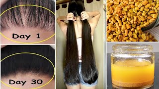 👉Extreme Hair Growth Oil  World’s Best Faster Remedy for Hair Growth  For Adults and Kids [upl. by Eey32]