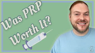 PRP Hair Loss Treatment Before and After [upl. by Maribel670]