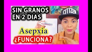 ELIMINA ACNE Y QUITA BARRITOS EN 2 DIAS 😱 ✅ ¿ASEPXIA SPOT FUNCIONA ✅ YOLIANA GAMBOA [upl. by Letsirc299]