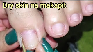 Vlog 174Dry SkinIngrown Removal PEDICURE 79 [upl. by Nahpos45]