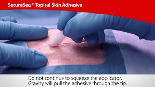 SecureSeal® Topical Skin Adhesive  Cardinal Health [upl. by Ymiaj]