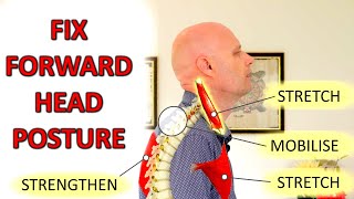 How To Fix Forward Head Posture amp Neck Pain [upl. by Howund]