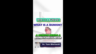 What is a Bunion [upl. by Cristi]