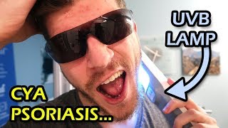 Psoriasis UVB Light Treatment From Home  Vlog 3 [upl. by Ebanreb]