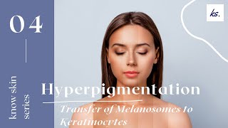 Hyperpigmentation series transfer of melanosomes to keratinocytes [upl. by Sihun888]