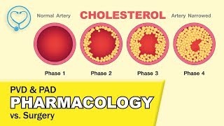 PAD vs PVD animation TOP 3 tested pharmacology treatments amp Surgery memory tricks for NCLEX rev [upl. by Xantha778]