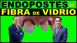 ENDOPOSTES DE FIBRA DE VIDRIO  PERNO ESTETICO DE ENDODONCIA [upl. by Petrie]