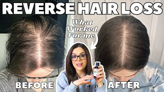 How I STOPPED MY HAIR LOSS  1 Thing That ReGrew My Hair [upl. by Lola843]