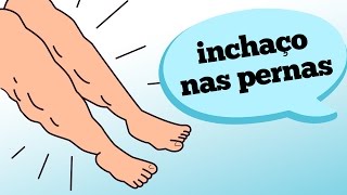 INCHAÇO NAS PERNAS O QUE PODE SER [upl. by Aynik]