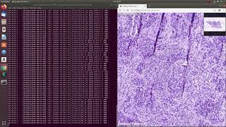 Deep Zoom for Whole Slide Images WSI with Python OpenSlide [upl. by Ribaj]