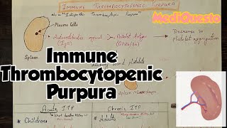 Immune Thrombocytopenic Purpura PlateletDisorders Hematology RobbinsPathology [upl. by Tattan]