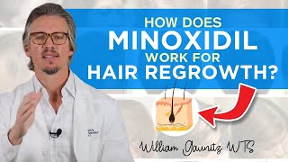 MINOXIDIL treatment for HAIR LOSS  How and When to use  What Patients Need to Know [upl. by Grochow]