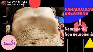 Paradoxical breathing pattern  Diaphragmatic paradox paradoxicalrespiration diaphragmaticpalsy [upl. by Cleland]