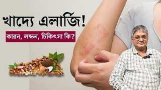 খাদ্য বা ফুড এলার্জির কারণ লক্ষণ ও চিকিৎসা  Food allergy Causes Symptoms amp Treatment in Bangla [upl. by Adna]