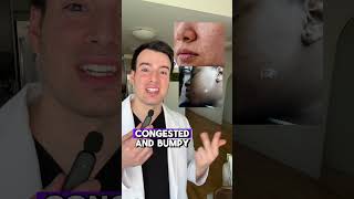 Congested Skin Derm explains [upl. by Adaven]