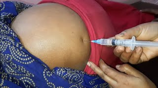 Intramuscular injection buttock in hindi injection injection Ep 113 [upl. by Elleivap]