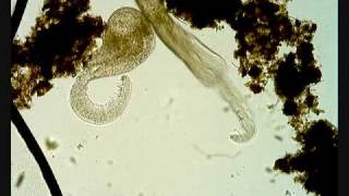 Cercaria parasite larval trematode [upl. by Atiran]