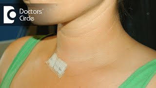 Can thyroid grow back after Total Thyroidectomy  Dr Anantharaman Ramakrishnan [upl. by Burrus953]