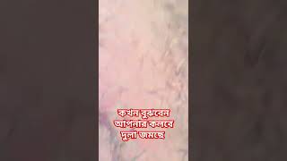 কি ভাবে বুঝবেন আপনার মনে ময়লা জমছে।islamicstatus islamicgojol foryou isalamicshort [upl. by Kumagai]