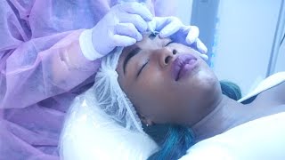 Microblading on DARK SKIN [upl. by Foley]