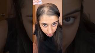 😱How To Grow Long Hair Stop Hairfall💯 shorts haircare hairgrowth RadhaSkincare [upl. by Venterea657]