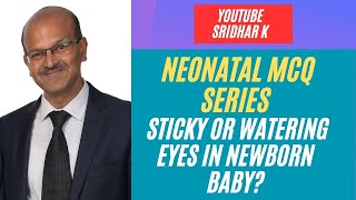 Sticky eyes in babies Nasolacrimal duct obstruction in babies Watering eyes in babies MCQ baby [upl. by Nysilla]