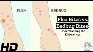 Bug Bite Showdown Identifying Flea vs Bedbug Bites [upl. by Crellen37]