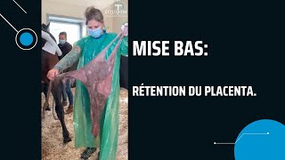 RETENTION DU PLACENTA APRES UNE NAISSANCE 🇬🇧 1m 12s [upl. by Weig]