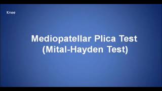 medio patellar plica test [upl. by Salisbarry]