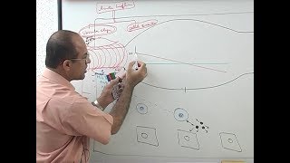 general pathology hyperaemiachronic venous congesion part 1 DR SAMEH GHAZY [upl. by Harmonie924]