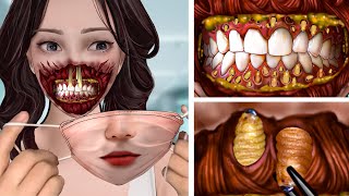 ASMR Remove Parasitic Maggots amp Mucus Causing Infection in the mouth  Deep Cleaning Animation [upl. by Middlesworth]