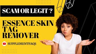 Essence Skin Tag Remover Reviews and Warning  Watch Before Buying [upl. by Ahselrak268]