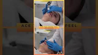 New Spicule peel  GWANG PEEL Technique by RIBESKIN acnetreatment skincare koreanskincare [upl. by Rollo]