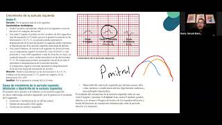 Crecimientos de cavidades  Diplomado de Electrocardiografía Básica nursing [upl. by Yelsnya]