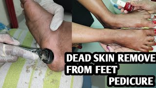 How to remove dead skin from feet SnehalBeautytips full PEDICURE VIDEO [upl. by Lac290]