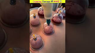 Secret of cupping therapy [upl. by Asseniv]