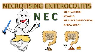 NEC  Necrotizing enterocolitis NEONATOLOGY SERIES CH6 [upl. by Sairacaz]