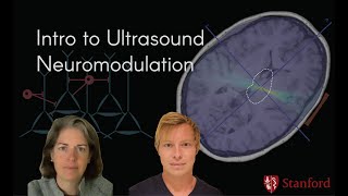 Intro to the 2021 Course on Ultrasound Neuromodulation with Dr Kim Butts Pauly and Dr Keith Murphy [upl. by Bremer76]