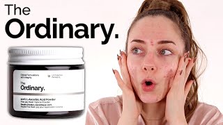 The Ordinary 100 LAscorbic Acid Powder Review  Vitamin C Powder [upl. by Hebrew385]